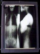 X-Ray Self Portrait